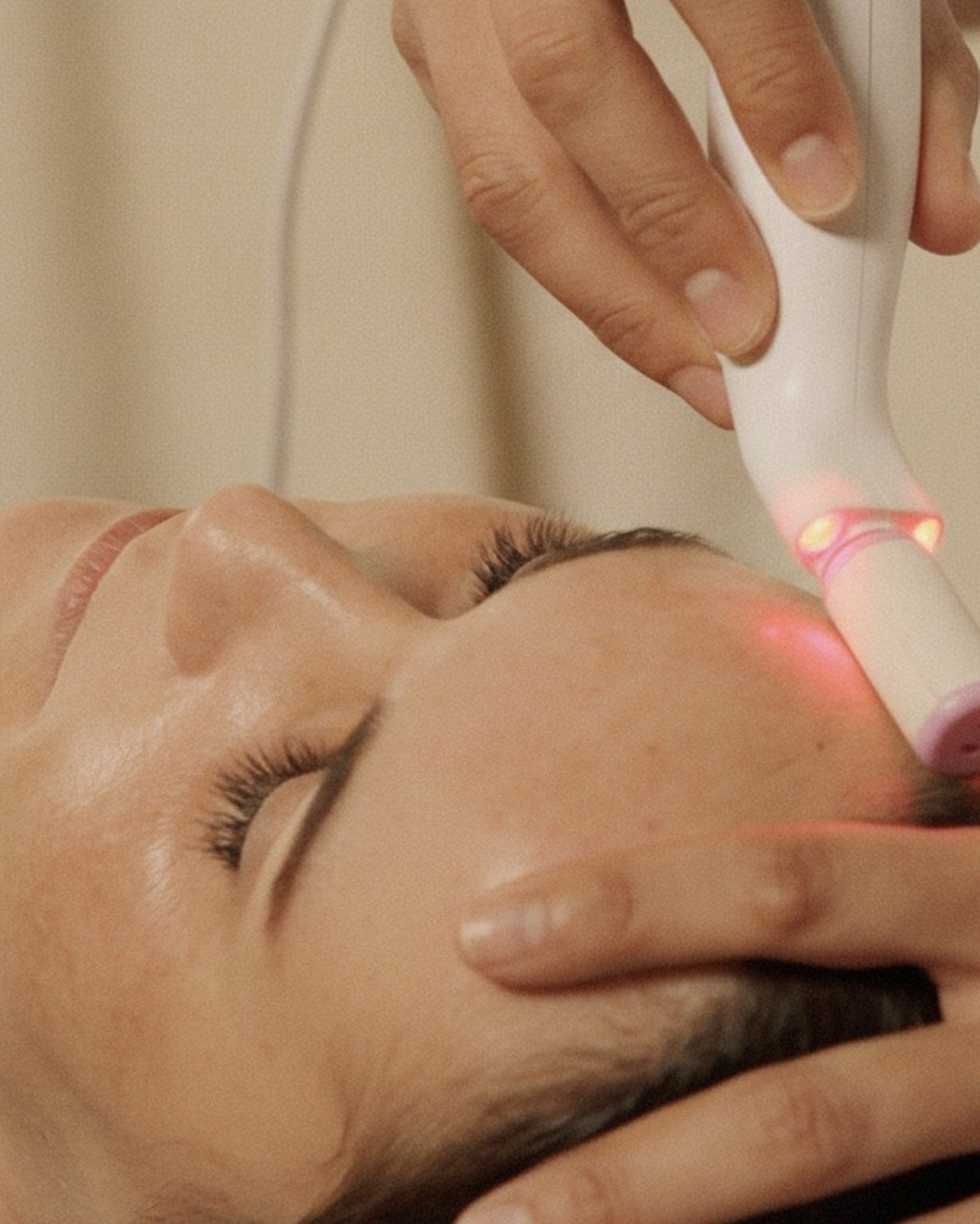 Soin resurfaçant Blooméa du visage chez Clinique Évia | Blooméa facial resurfacing treatment at Clinique Évia